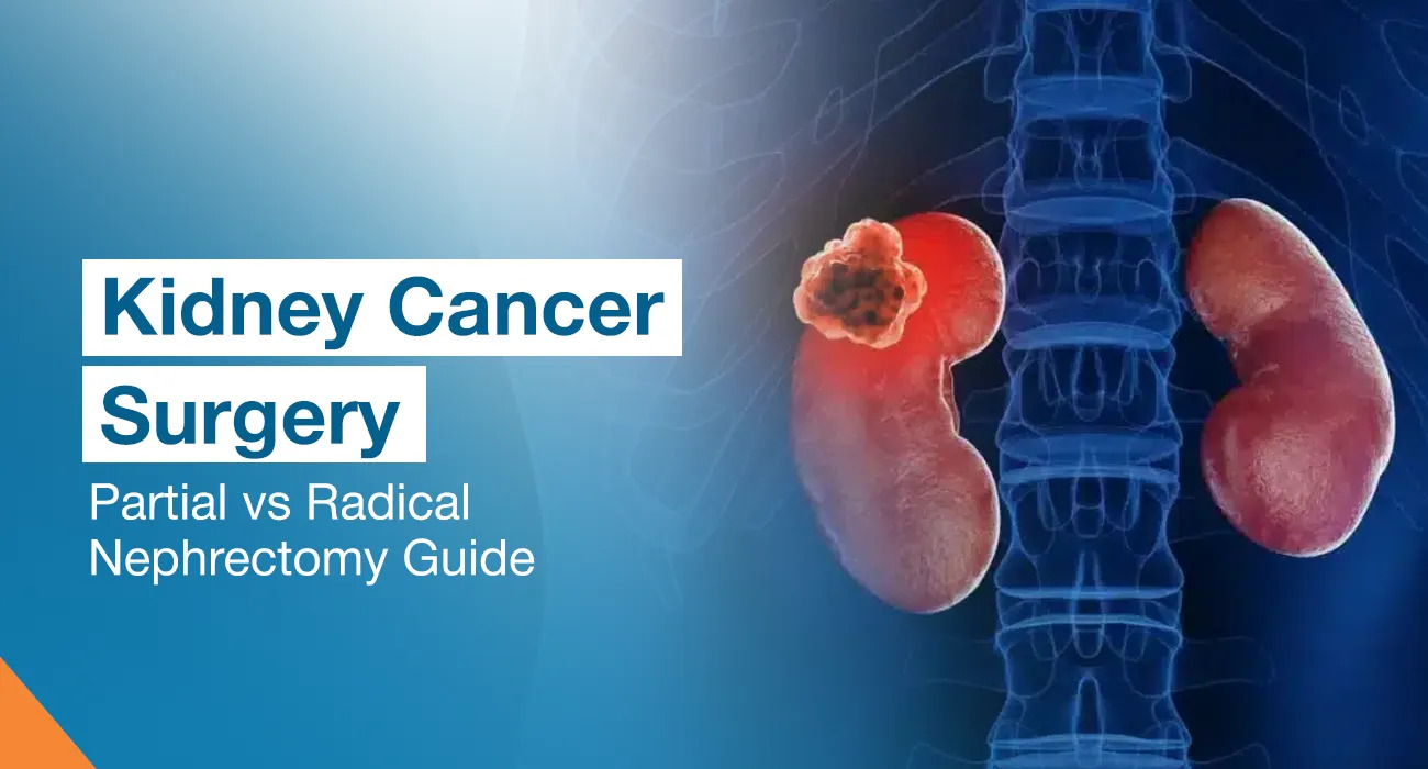 Kidney Cancer Surgery: Partial vs Radical Nephrectomy Explained